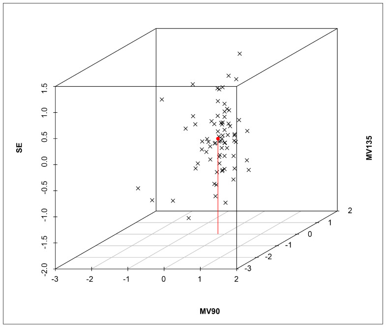 Evaluation of Portable, Low-Cost Autorefractor in School Students with Limited Eye Care Access in Northeastern Brazil.
