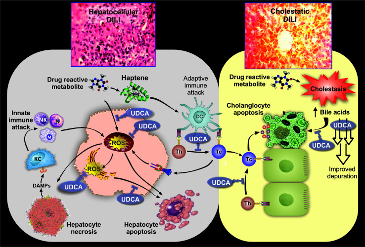 Ursodeoxycholic Acid for the Management of Drug-induced Liver Injury: Role of Hepatoprotective and Anti-cholestatic Mechanisms.