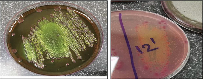 Identification of <i>mcr-2</i> and <i>mcr-3</i> Genes in Colistin-Resistant <i>E. coli</i> O157:H7 Isolated From Raw Meat Samples in Beirut, Lebanon.