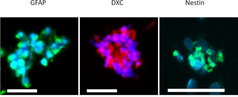 Neural progenitor cell-derived exosomes in ischemia/reperfusion injury in cardiomyoblasts.