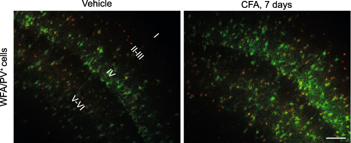 A type-5 metabotropic glutamate receptor-perineuronal net axis shapes the function of cortical GABAergic interneurons in chronic pain.