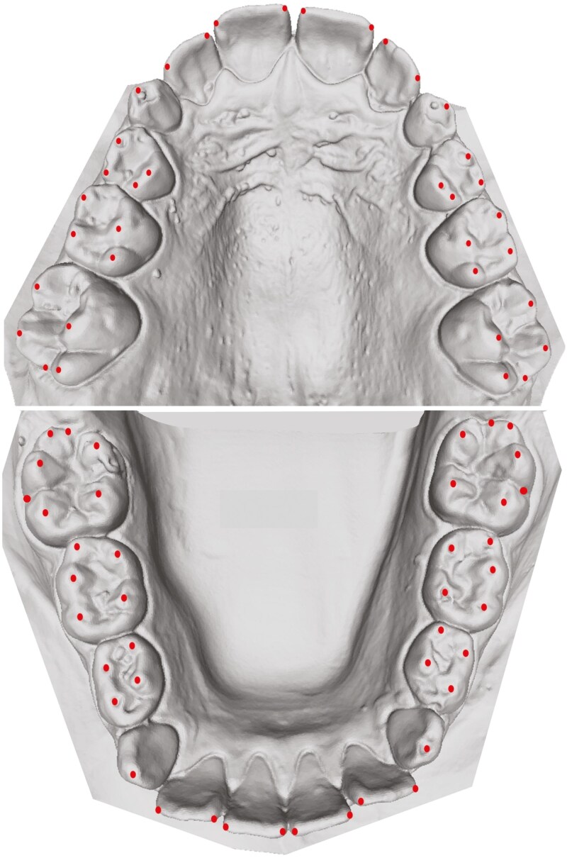 Genetic and environmental contributions to the development of dental arch traits: a longitudinal twin study.