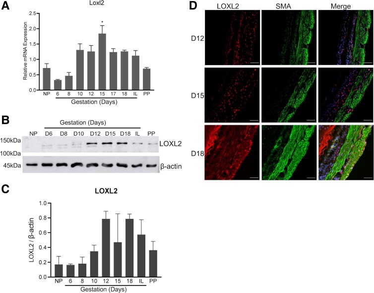 Lysyl Oxidases Are Necessary for Myometrial Contractility and On-time Parturition in Mice.