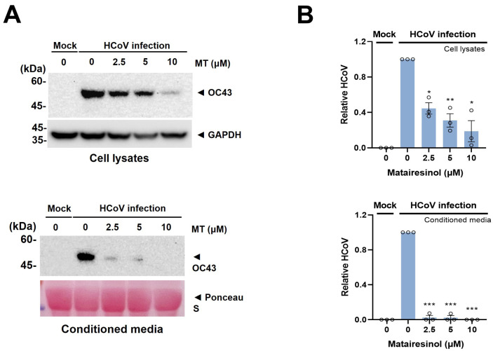 Matairesinol Treatment Interferes with the Replication of Coronavirus.