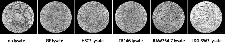 Oral cell lysates reduce osteoclastogenesis in murine bone marrow cultures.