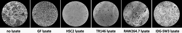 Oral cell lysates reduce osteoclastogenesis in murine bone marrow cultures.