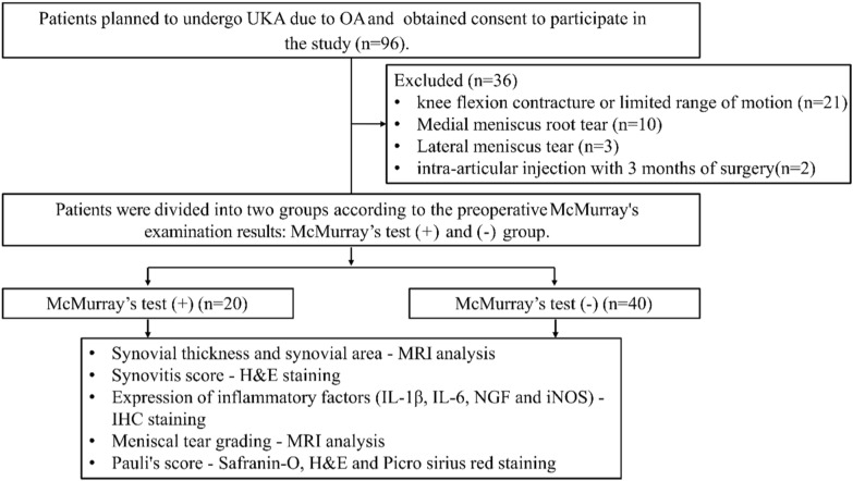 McMurray's test is influenced by perimeniscal synovitis in degenerative meniscus tears.