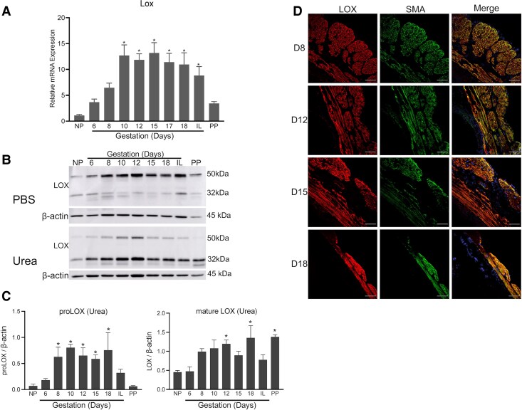 Lysyl Oxidases Are Necessary for Myometrial Contractility and On-time Parturition in Mice.