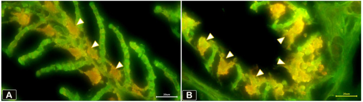 Anatomy, histology, and morphology of fish gills in relation to feeding habits: a comparative review of marine and freshwater species.