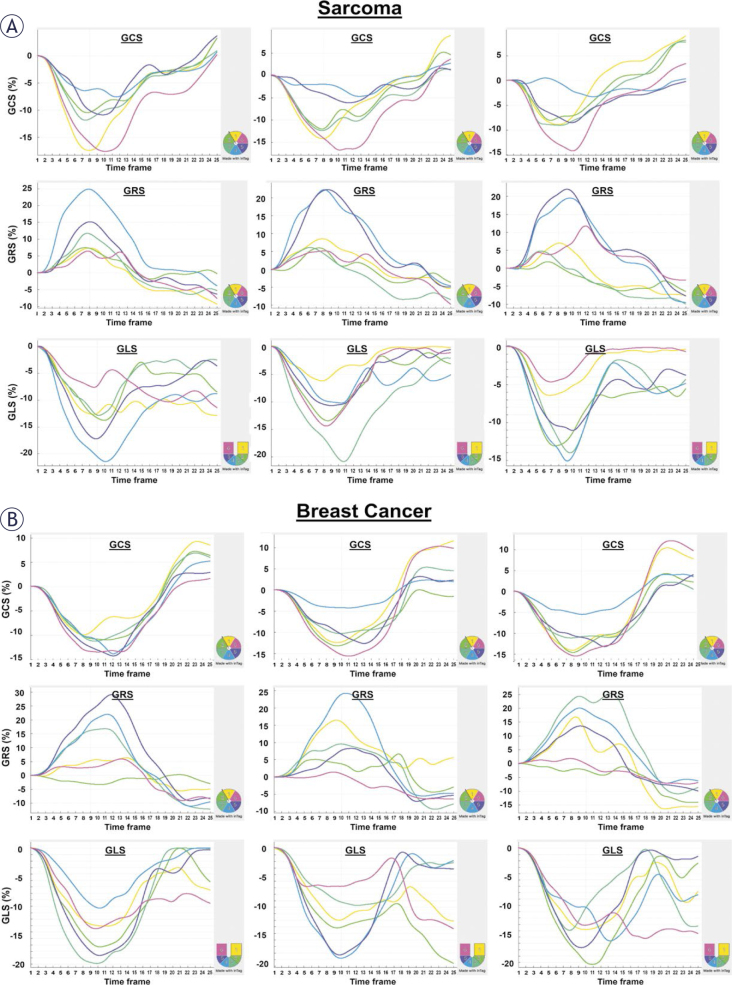 Cardiac MRI for differentiating chemotherapy-induced cardiotoxicity in sarcoma and breast cancer.