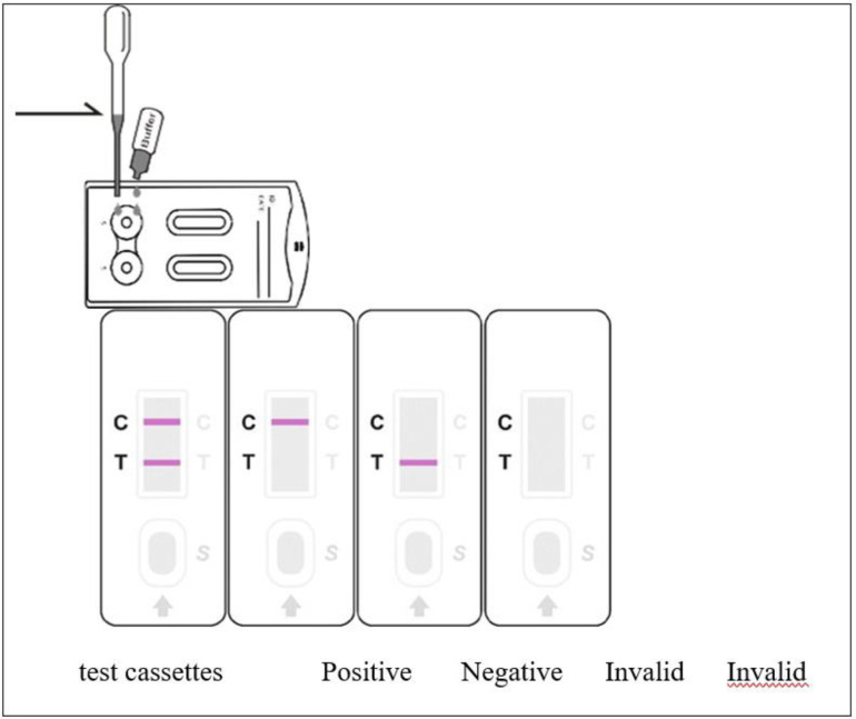 Serological epidemiology analysis of Cytomegalovirus infection in pregnant women in Diwaniyah, Iraq.
