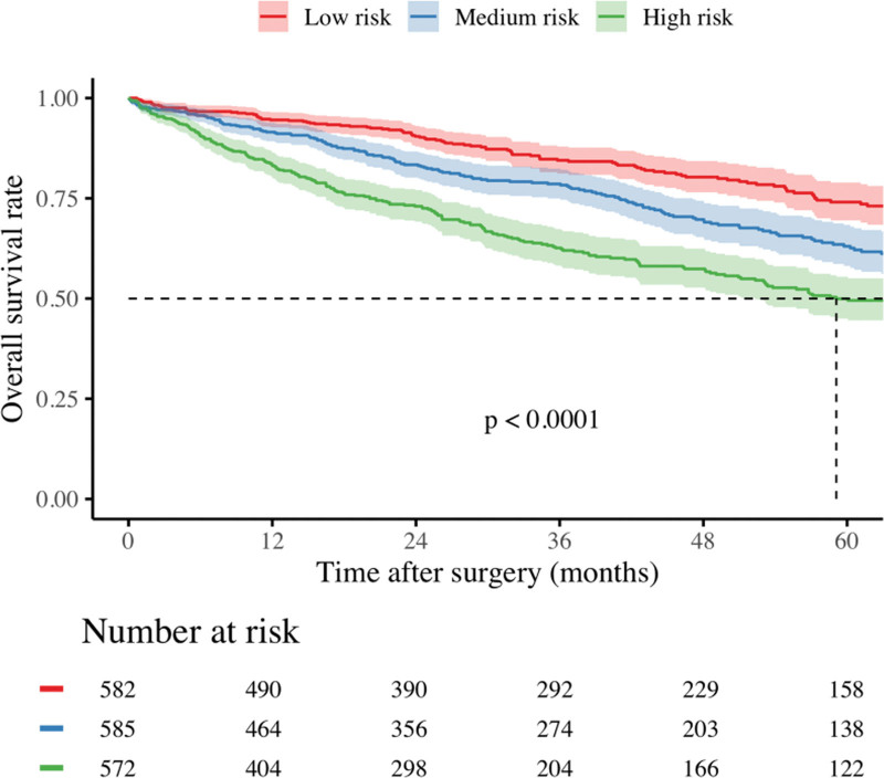 International Validation and Refinement of Oncological Borderline Resectability Criteria for Hepatocellular Carcinoma Using Tumor Burden Score to Predict Survival.