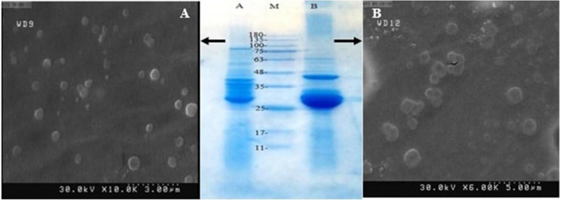 Characterization of <i>Escherichia coli</i> outer membrane vesicles and the impact of pathogenic ones on NLR signaling pathways.