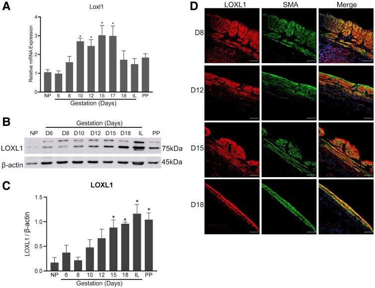 Lysyl Oxidases Are Necessary for Myometrial Contractility and On-time Parturition in Mice.