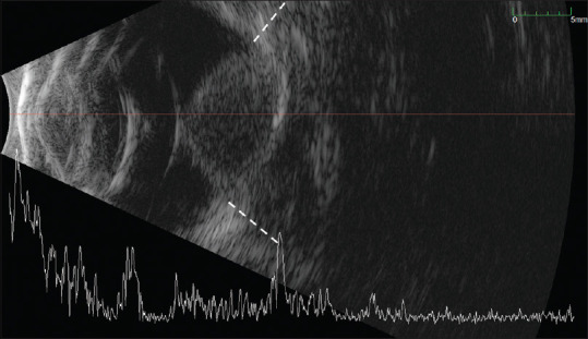 Innovations in brachytherapy.