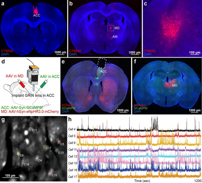 Roles of mediodorsal thalamus in observational fear-related neural activity in mouse anterior cingulate cortex.