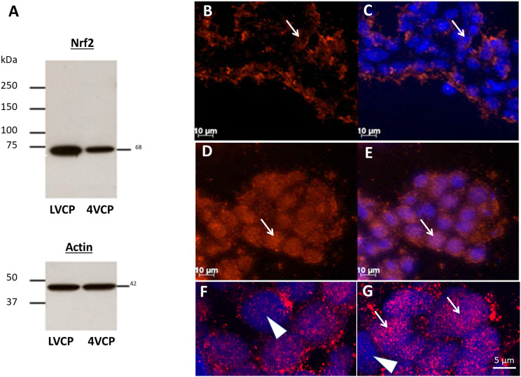 The glutathione-dependent neuroprotective activity of the blood-CSF barrier is inducible through the Nrf2 signaling pathway during postnatal development.