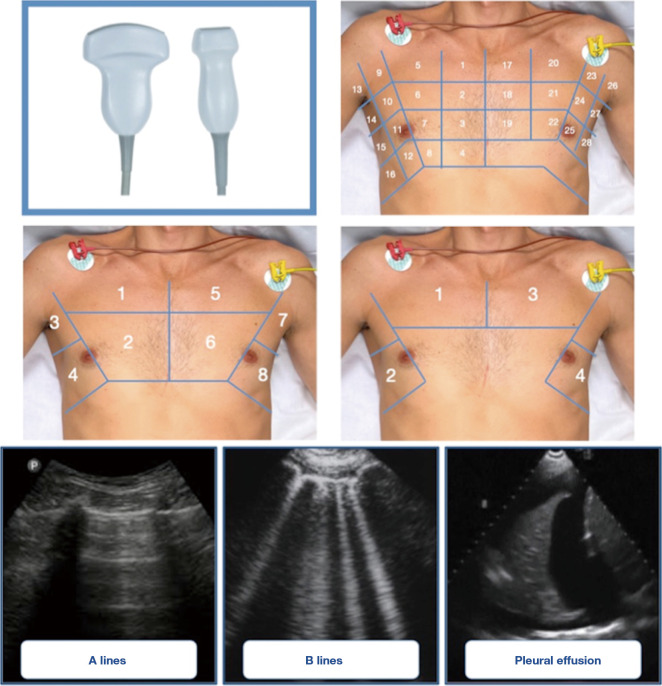 Ultrasound imaging of congestion in heart failure: a narrative review.