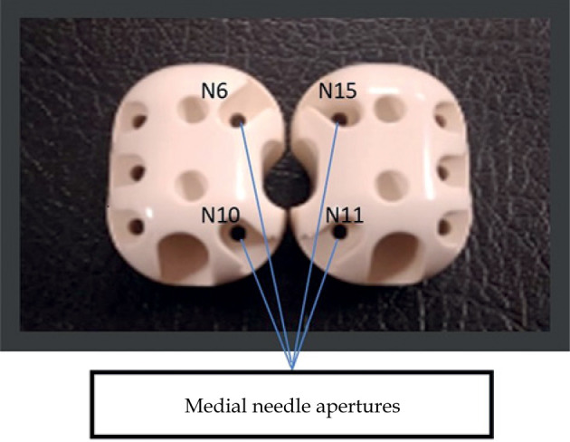 Efficacy of medial needles in mitigating dose deficits from sub-optimally inserted tandems in cervical interstitial brachytherapy.