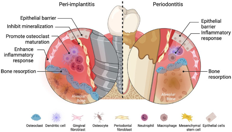 DNA and RNA Methylation in Periodontal and Peri-implant Diseases.