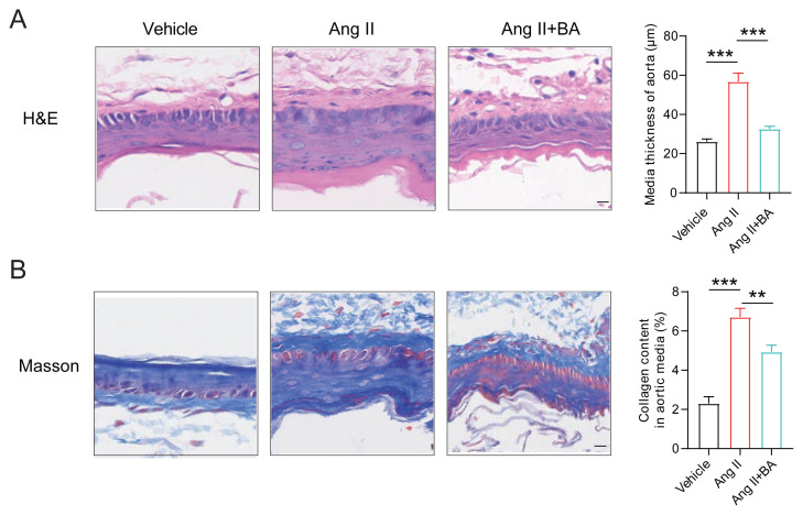 Benzyl alcohol improves Ang II-induced vascular and renal injury.