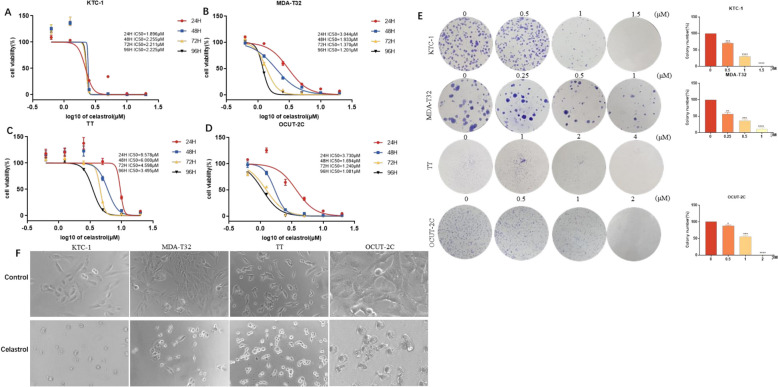 Celastrol promotes apoptotic cell death in thyroid cancer cells through a caspases-dependent pathway.
