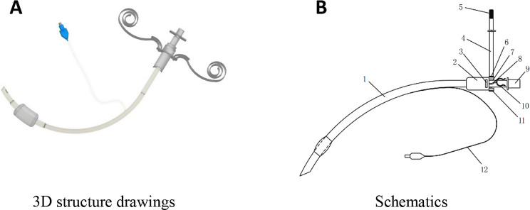 Application of double-sleeve endotracheal tube in infection control for icu patients: a randomized controlled trial.