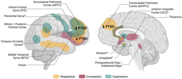 Neural correlates and plasticity of explicit emotion regulation following the experience of trauma.