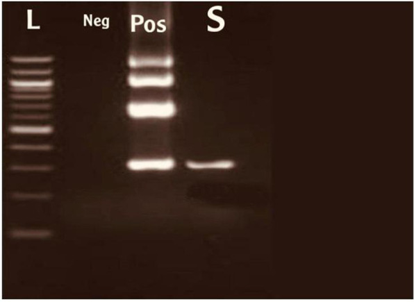 Incidence of extended spectrum beta-lactamase (ESBL) producing <i>Escherichia coli</i> isolated from women with urinary tract infections in Jordan.