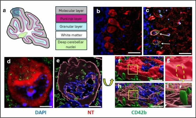 A New Perspective on Mechanisms of Neurodegeneration in Experimental Autoimmune Encephalomyelitis and Multiple Sclerosis: the Early and Critical Role of Platelets in Neuro/Axonal Loss.