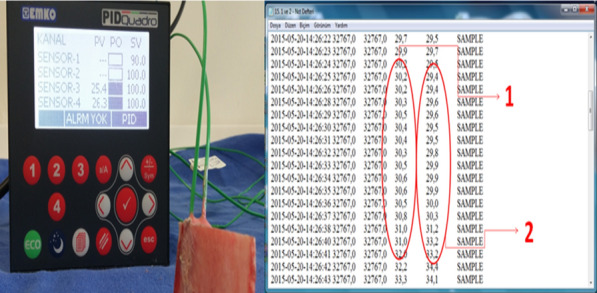 In-vitro investigation of bone temperature changes in osteotomies performed with different brands of implant burs.