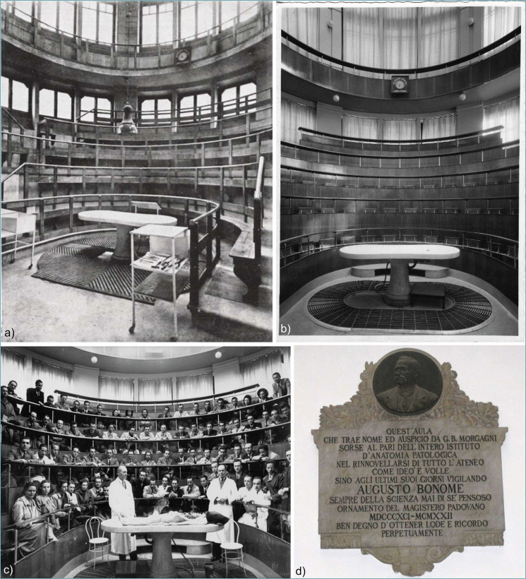 The Morgagni Anatomical Theatre: 100 Years of Pathological Anatomy Education at the University of Padua (1924-2024).