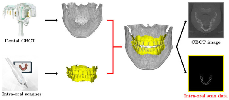 Patient-Specific Orthognathic Solutions: Expert Opinion on Guidelines and Workflow.