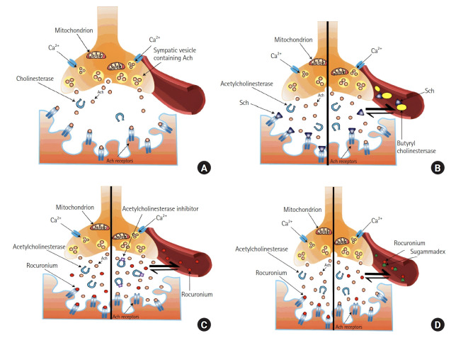 Current evidence on the use of sugammadex for neuromuscular blockade antagonism during electroconvulsive therapy: a narrative review.