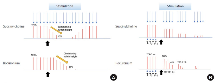 Current evidence on the use of sugammadex for neuromuscular blockade antagonism during electroconvulsive therapy: a narrative review.