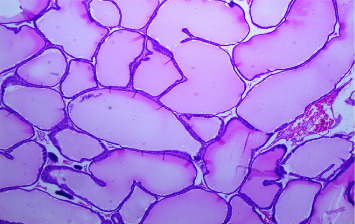 Assessing the Safety of Combined Therapy, <i>Croton membranaceus</i> and Tamsulosin, in the Self-Prescribed Treatment Protocol for Benign Prostatic Hyperplasia.