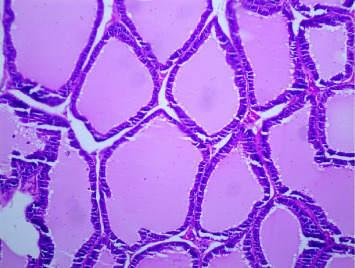 Assessing the Safety of Combined Therapy, <i>Croton membranaceus</i> and Tamsulosin, in the Self-Prescribed Treatment Protocol for Benign Prostatic Hyperplasia.