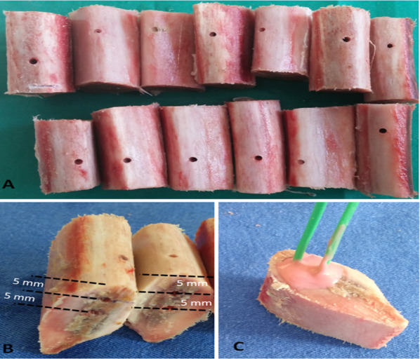 In-vitro investigation of bone temperature changes in osteotomies performed with different brands of implant burs.