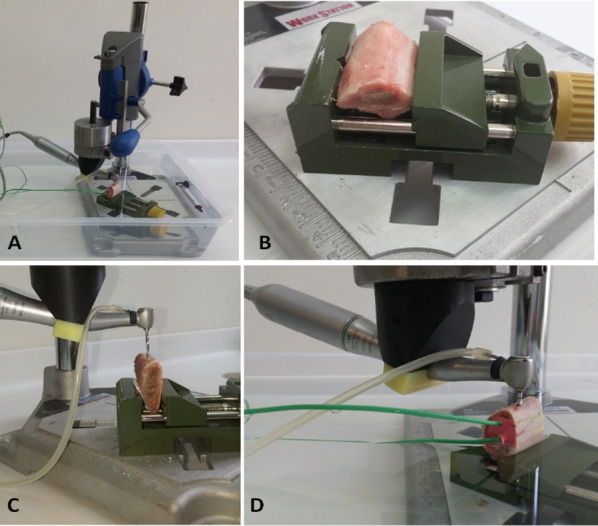 In-vitro investigation of bone temperature changes in osteotomies performed with different brands of implant burs.