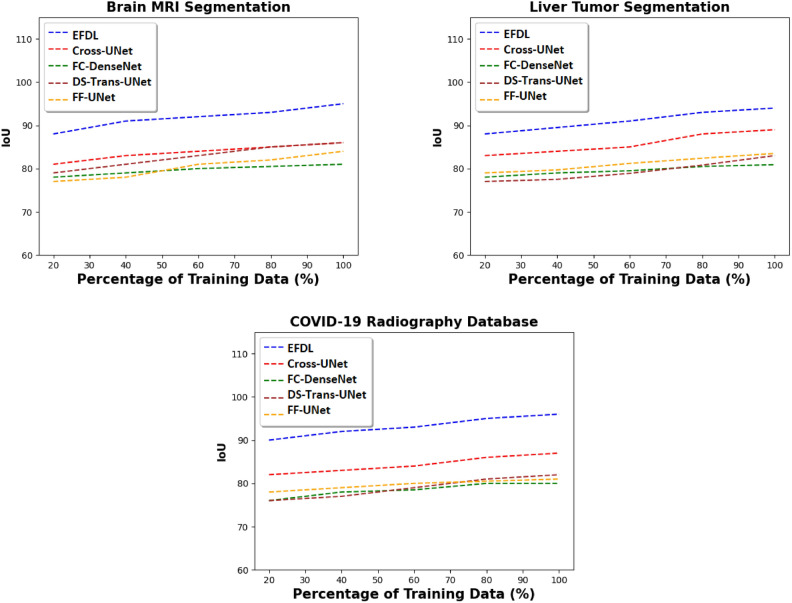 Ensemble fuzzy deep learning for brain tumor detection.
