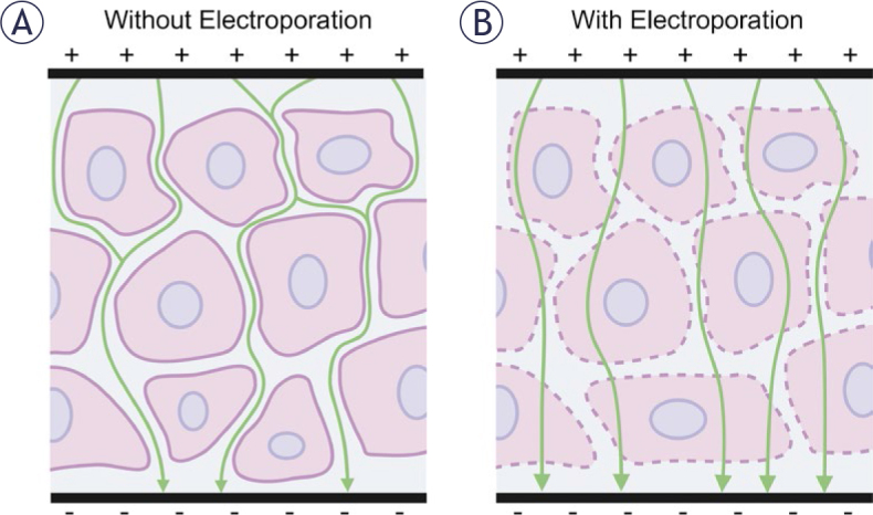 Pulsed field ablation in medicine: irreversible electroporation and electropermeabilization theory and applications.