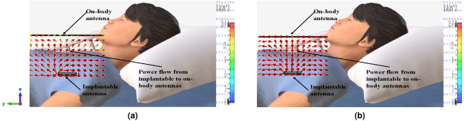 RF communication between dual band implantable and on body antennas for biotelemetry application.