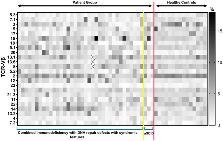 Evaluation of T-cell repertoire by flow cytometric analysis in primary immunodeficiencies with DNA repair defects.