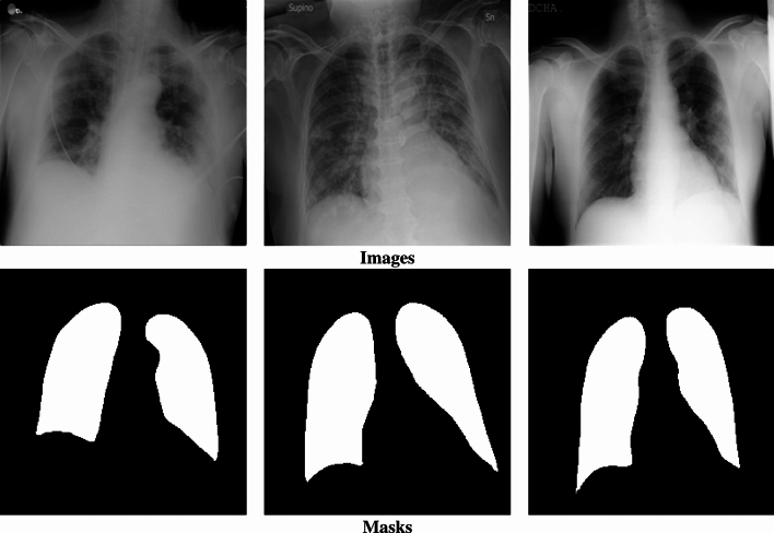 Ensemble fuzzy deep learning for brain tumor detection.