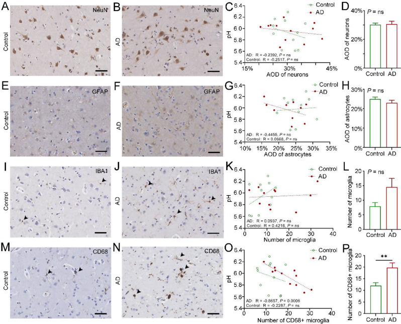 Changes in the pH value of the human brain in Alzheimer's disease pathology correlated with CD68-positive microglia: a community-based autopsy study in Beijing, China.