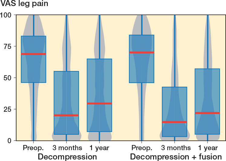 1-year results of lumbar spinal stenosis surgery in Finland: a national FinSpine register study.