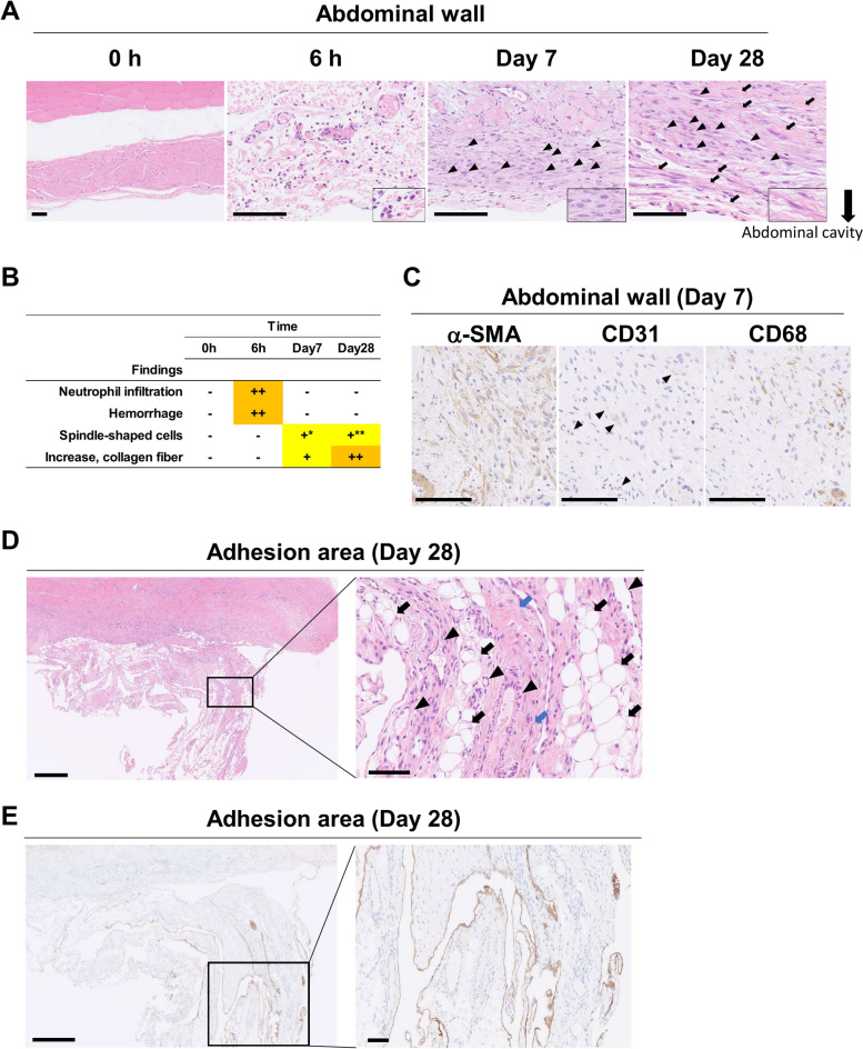 Development of a novel postoperative adhesion induction model in cynomolgus monkeys with high reliability and reproducibility.