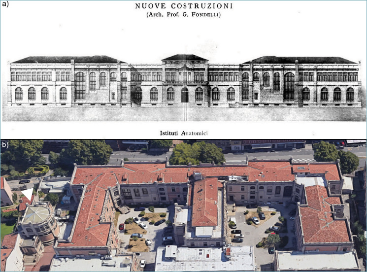 The Morgagni Anatomical Theatre: 100 Years of Pathological Anatomy Education at the University of Padua (1924-2024).