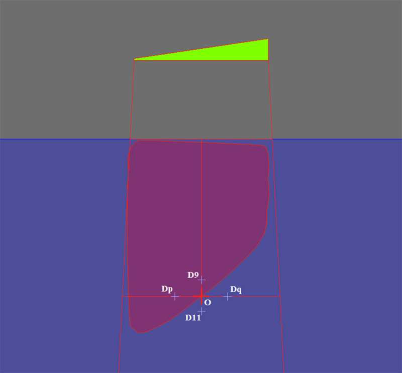 Assessment of Dose Calculation Accuracy of Monaco Treatment Planning System for Effective Wedge Angle in Internal Wedged Fields using Two Different Analytical Methods.