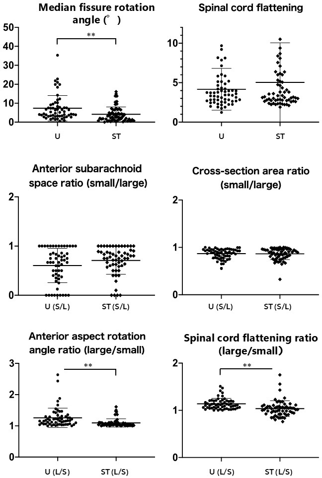 Clinical and Imaging Characteristics of Patients with Cervical Compressive Myelopathy Presenting with Unilateral Motor Deficits.